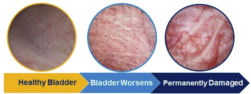bladder images
